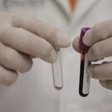 Tratamiento experimental habría eliminado VIH en brasileño