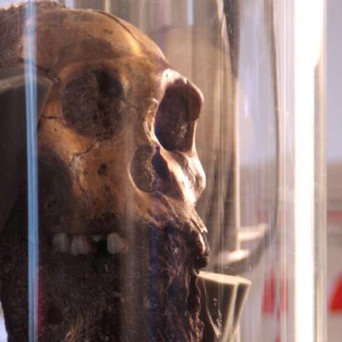 Fósil hallado en África es el caso de cáncer más antiguo conocido