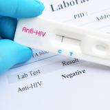 VIH: conoce las pruebas disponibles y cómo funcionan