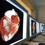 Europa promueve la reanimación cardíaca: “Si no haces nada, es un muerto” 
