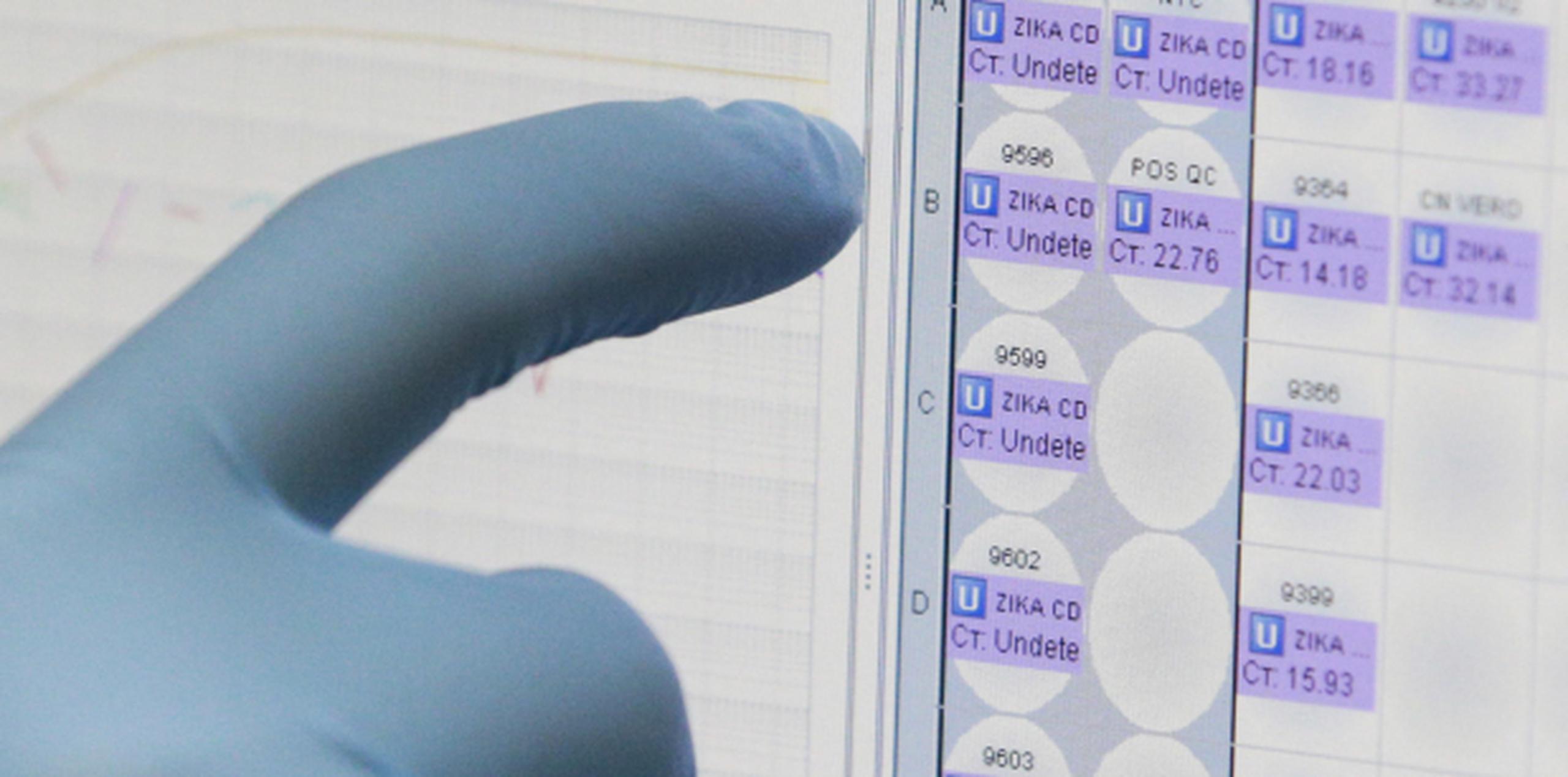 Prueba de orina simplificaría detección de zika Primera Hora