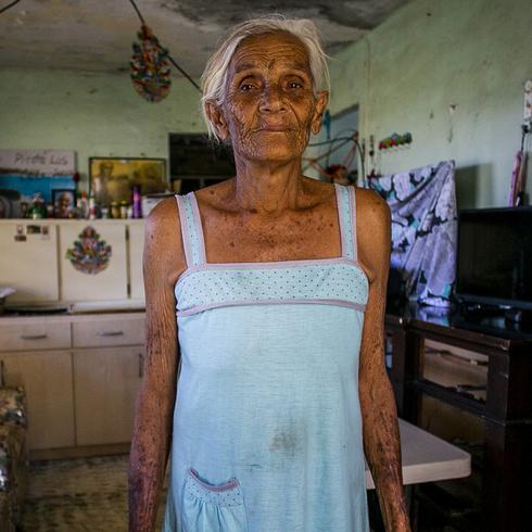 “Yo me abochorno”: anciana vive en condiciones deplorables en Yabucoa