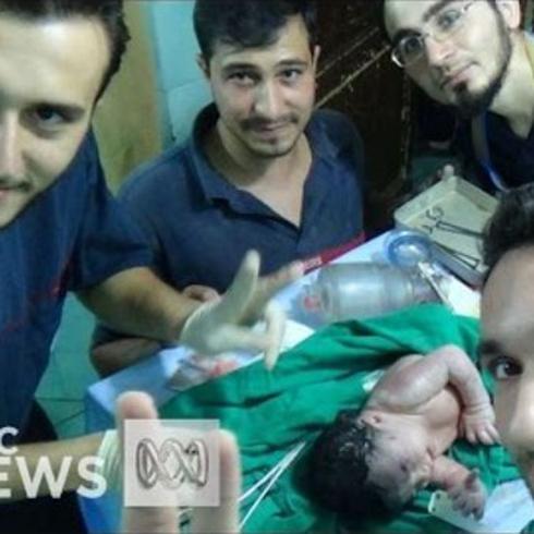 Bebé nace con herida de metralla que hirió a su madre