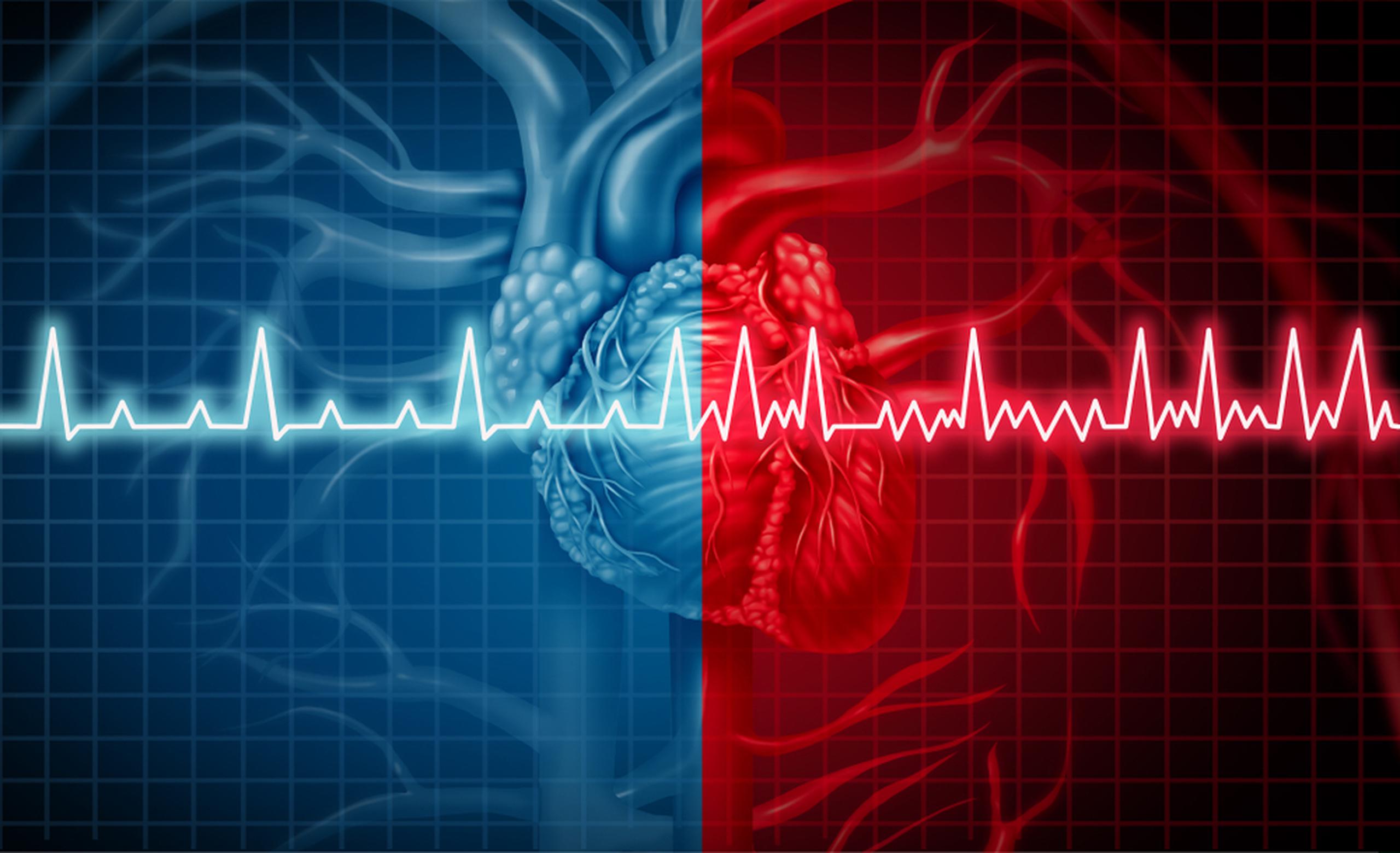 Los factores de riesgo para la fibrilación auricular son los mismos que para las condiciones cardiovasculares.