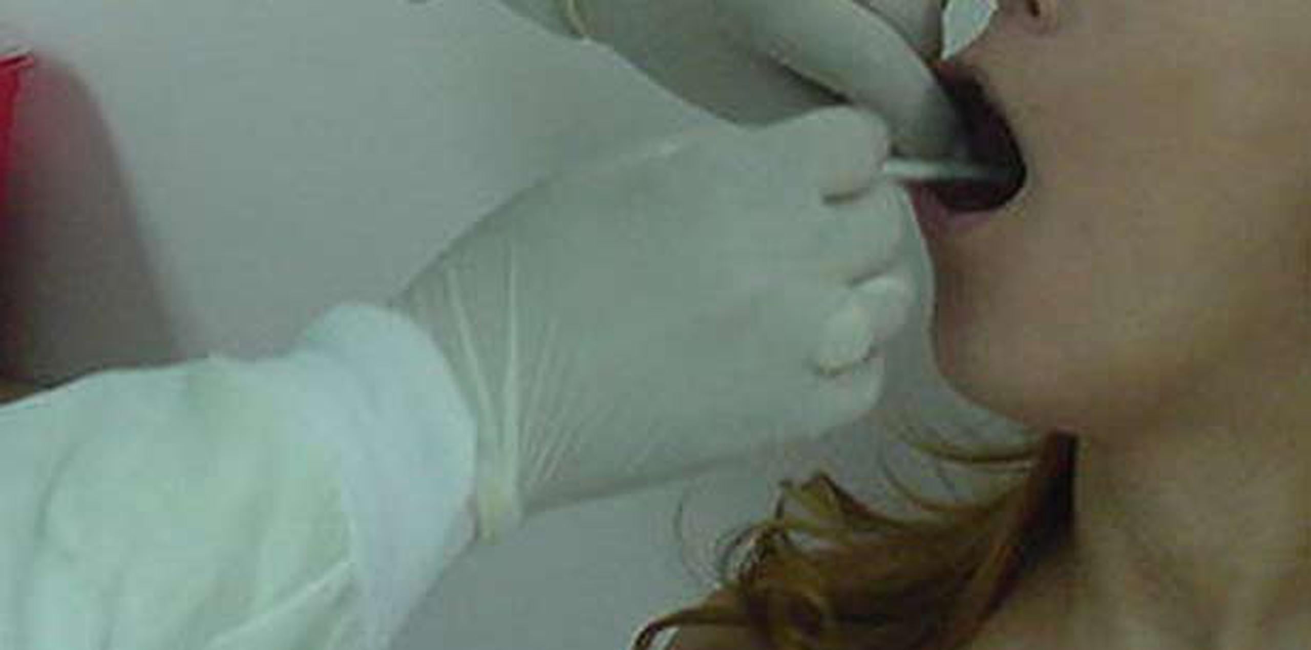 La prueba más fácil se realiza utilizando un hisopo para tomar una muestra del marcador genético desde el interior de la mejilla. (Archivo)