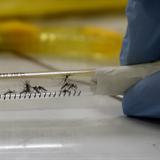 Florida reporta primer caso de zika por sexo en el 2017