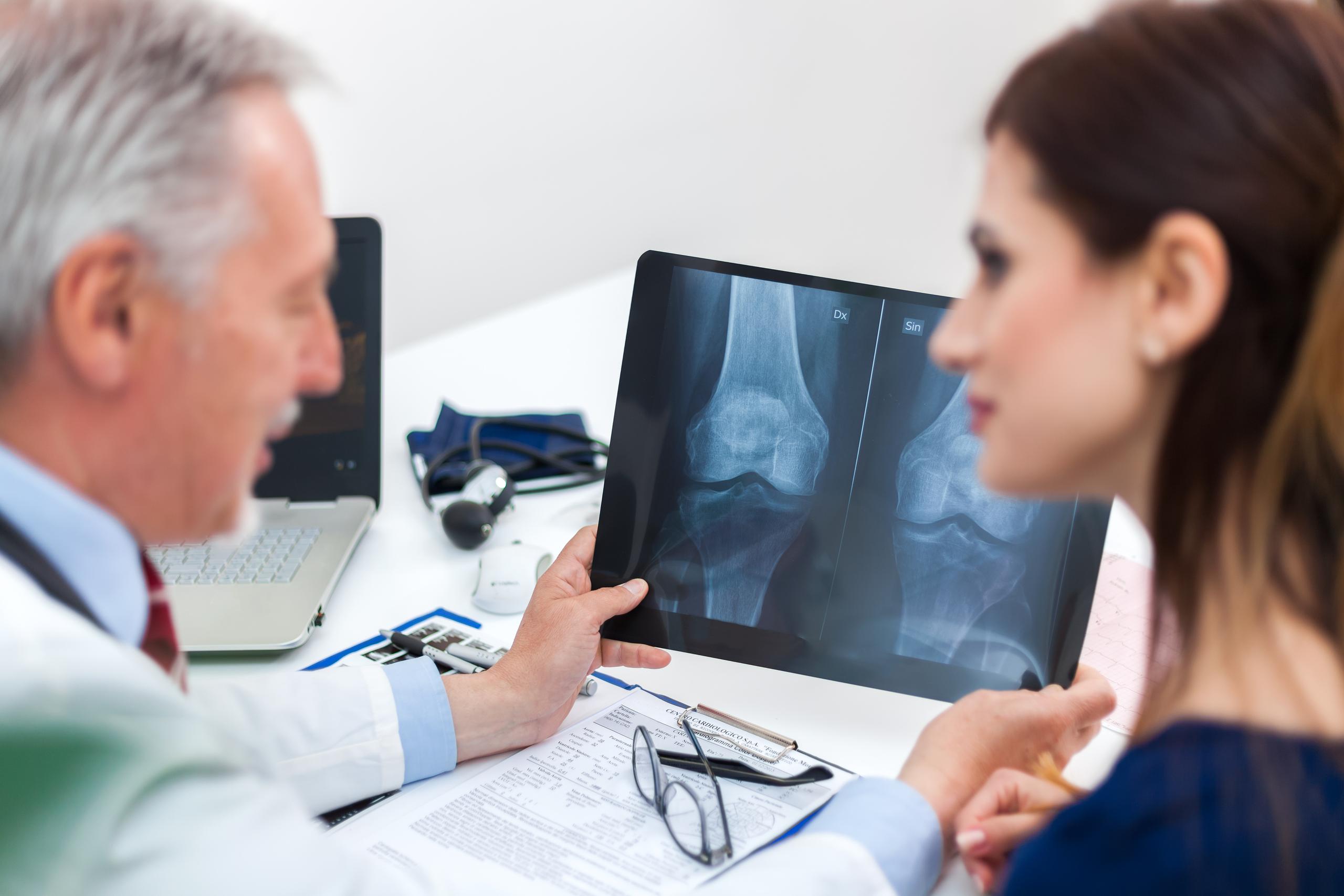 Las radiografías simples de los huesos afectados muestran osteoporosis cuando ésta ya está bastante avanzada, por ello la importancia de realizarse un examen de densidad ósea.
