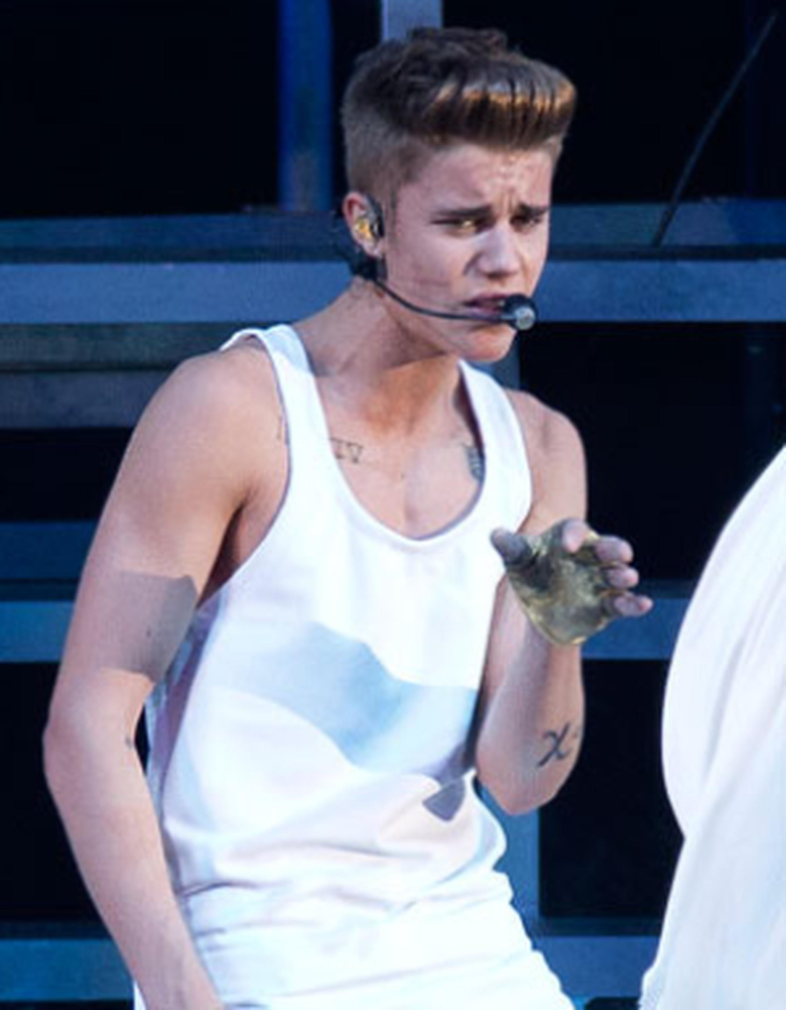 Bieber logró regresar al espectáculo, pidiendo disculpas a su fanaticada, y luego fue llevado al hospital más cercano. (AP / Joel Ryan)