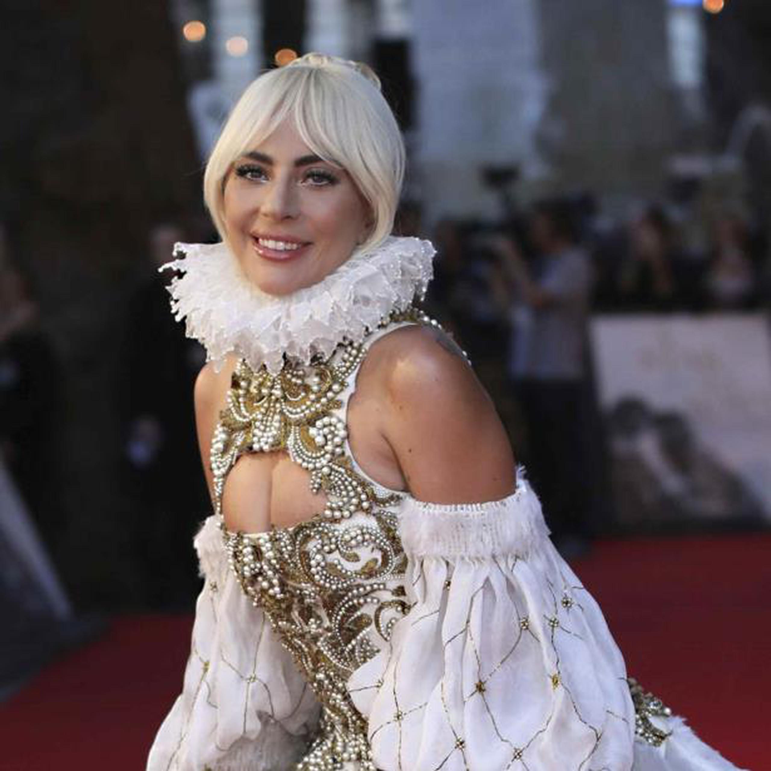 Lady Gaga padece de fibromialgia, una condición marcada por dolores musculoesqueléticos crónicos y generalizados que la ha llevado a cancelar varios conciertos. (Archivo)