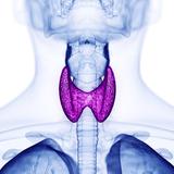 Problemas de tiroides: los más comunes en la isla