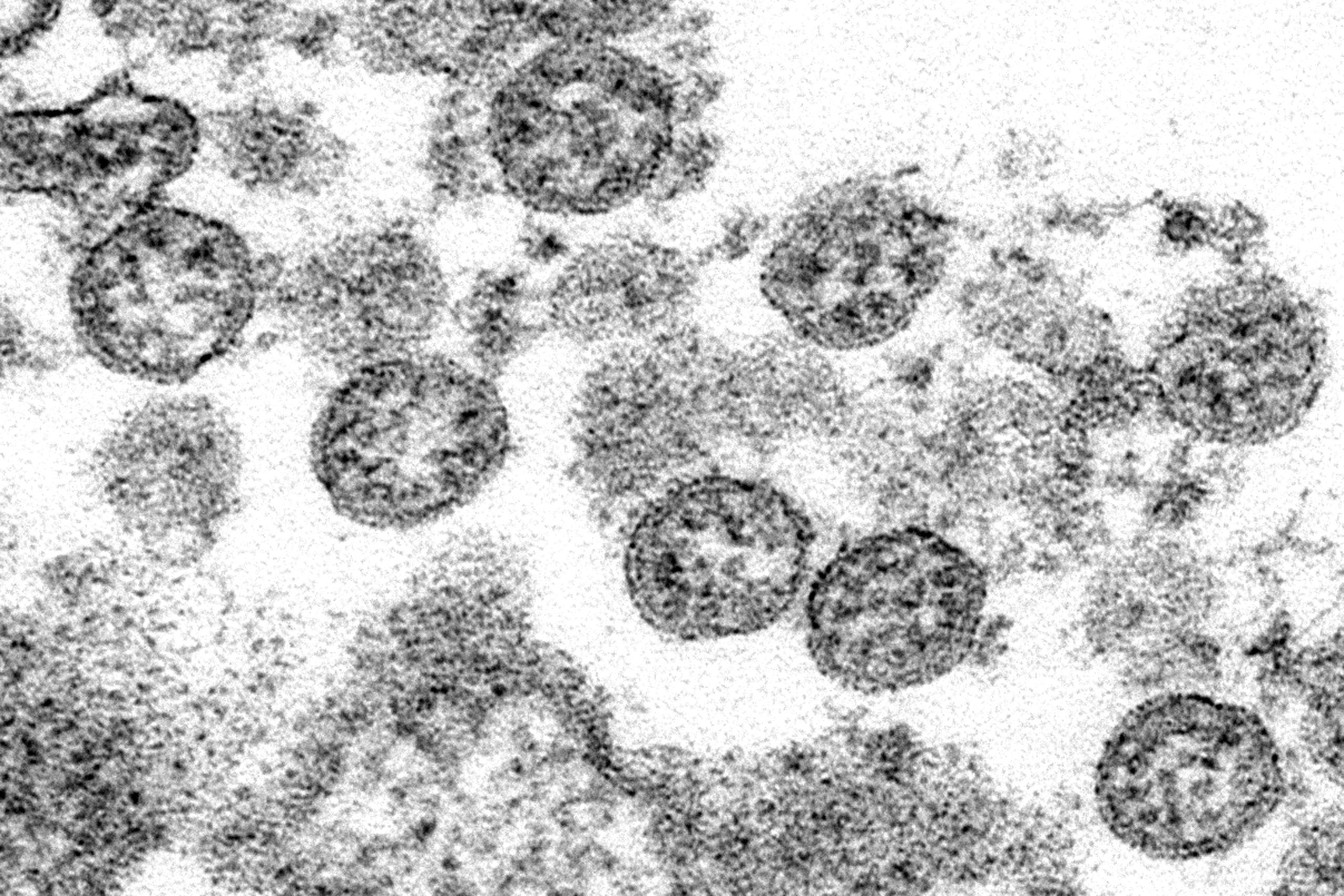 Esta imagen de microscopio cortesía de los Centros para el Control y Prevención de Enfermedades de Estados Unidos muestra partículas esféricas de coronavirus del primer caso de covid-19 en Estados Unidos