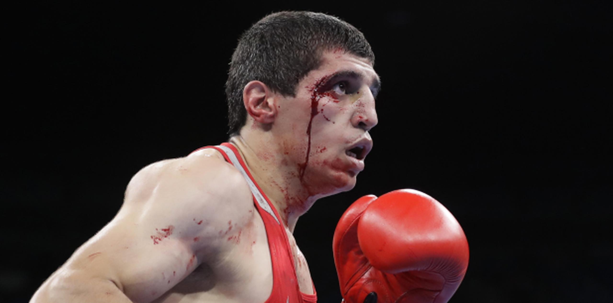 Vladimir Margaryan es uno de cerca de 12 boxeadores que ha terminado ensangrentado tras un combate en Río, y perdió su pelea cuando ante el sangrado no se permitió que continuara el combate. (AP)