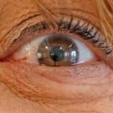 Minorías en Estados Unidos con cirugía de retina tienen peores resultados que blancos