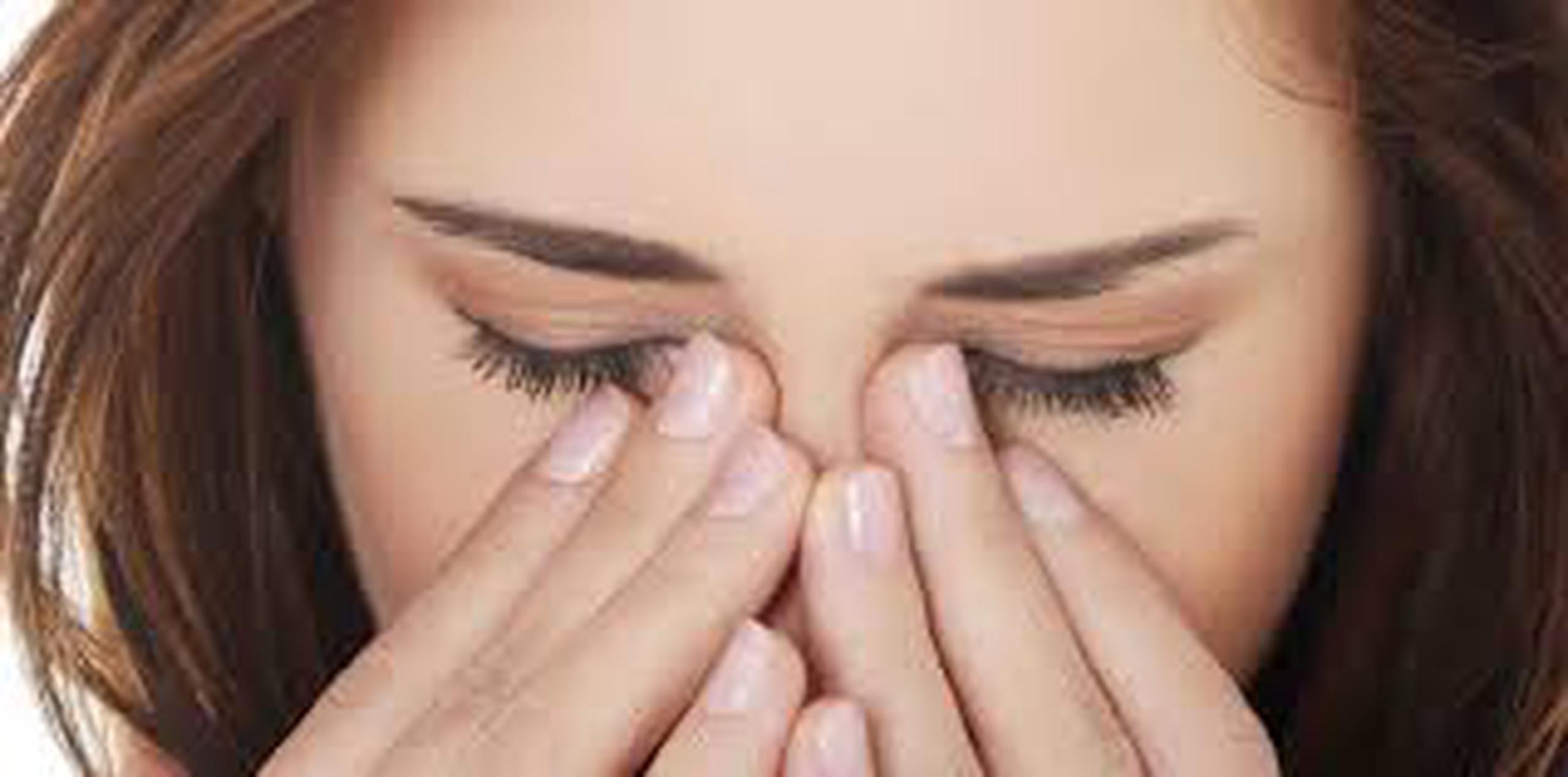La conjuntivitis viral es bien contagiosa y dependiendo de la severidad de los síntomas se puede tratar desde con lágrimas artificiales hasta antinflamatorios. (Archivo)