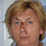 Misterio de mujer hallada que no recuerda quién es mantiene en vilo a Croacia