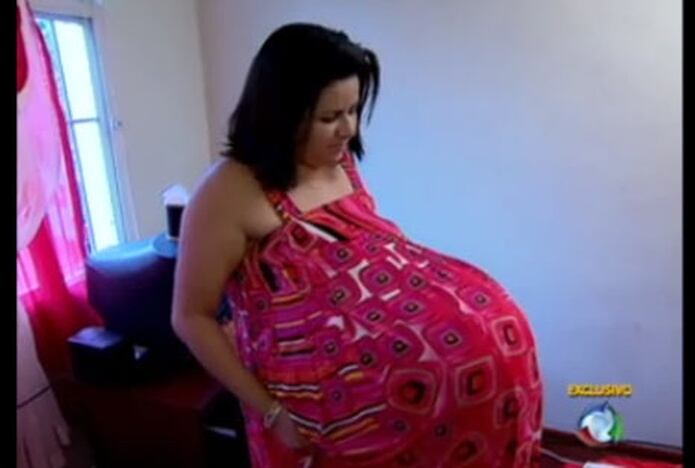 Mujer finge estar embarazada de cuatrillizas en Brasil - Ve vídeo