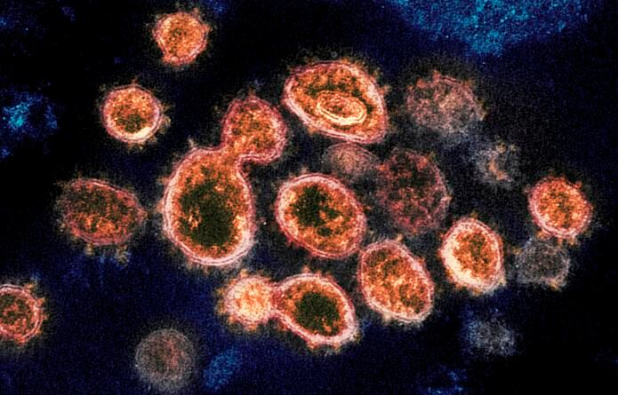 Imagen de un microscopio electrónico que muestra partículas del virus SARS-CoV-2 que causan COVID-19, aisladas de un paciente.