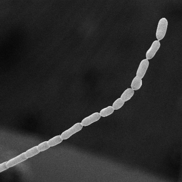 Esta fotografía captada al microscopio, facilitada por el Laboratorio Nacional Lawrence Berkeley en junio de 2022, muestra parte de una bacteria thiomargarita magnifica -la más grande que se conozca- que fue descubierta en el archipiélago de Guadalupe, posesión francesa en el Caribe.