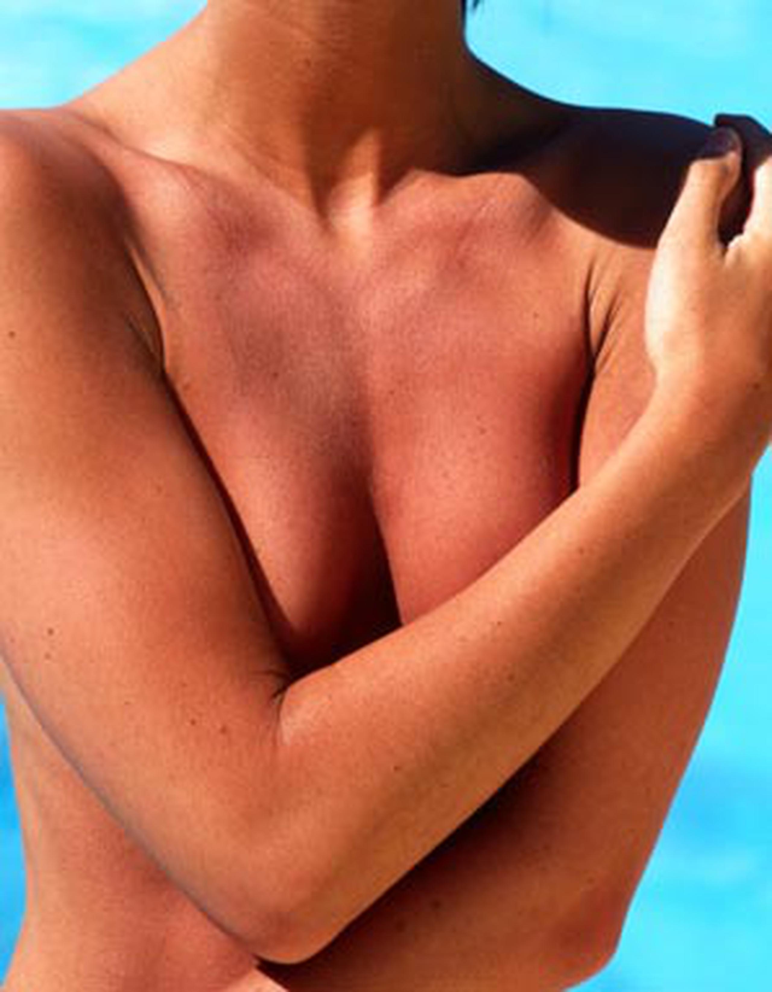 Desde 1998 el cirujano Ian Paterson practicó mastectomías en las que dejaba tejidos mamarios por motivos estéticos. (Archivo)