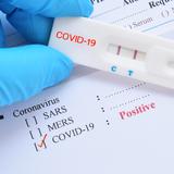 Muchas infecciones en Estados Unidos por COVID-19, pero pocas muertes