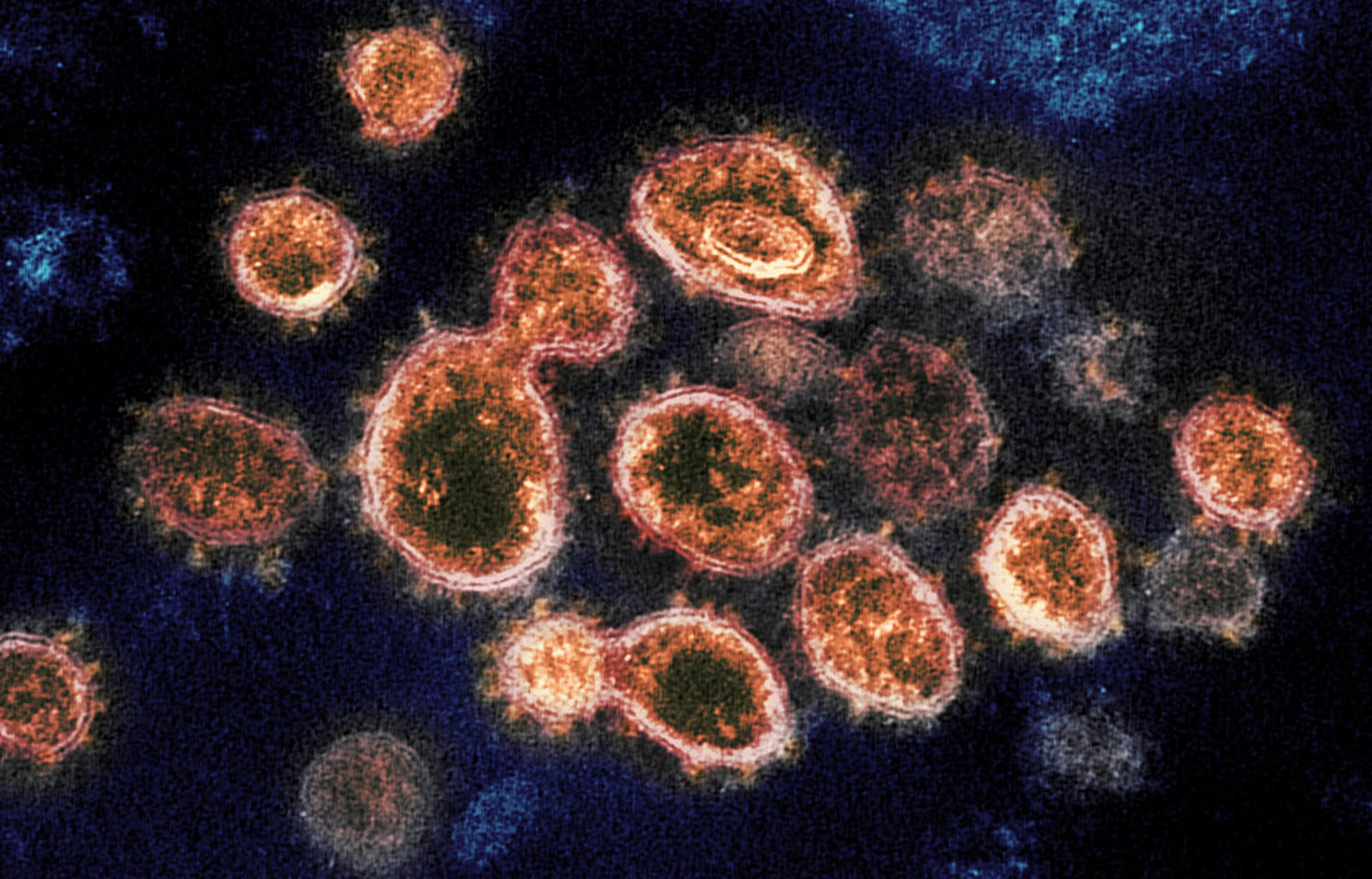 Los virus experimentan constantemente pequeños cambios a medida que se propagan de persona a persona.