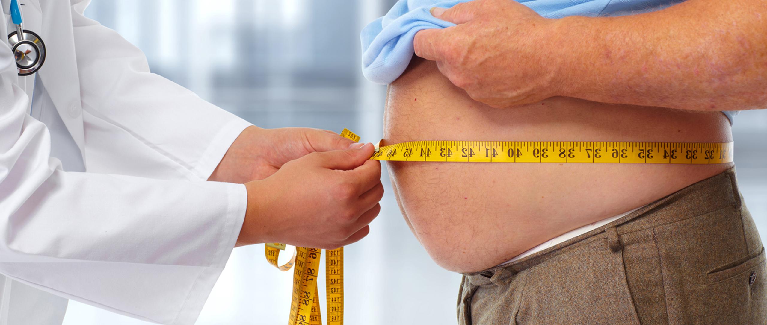 Los pacientes deben entender que llegar al peso deseado no es cuestión de uno o dos meses, sino que revertir la obesidad llevará tiempo. (Shutterstock)