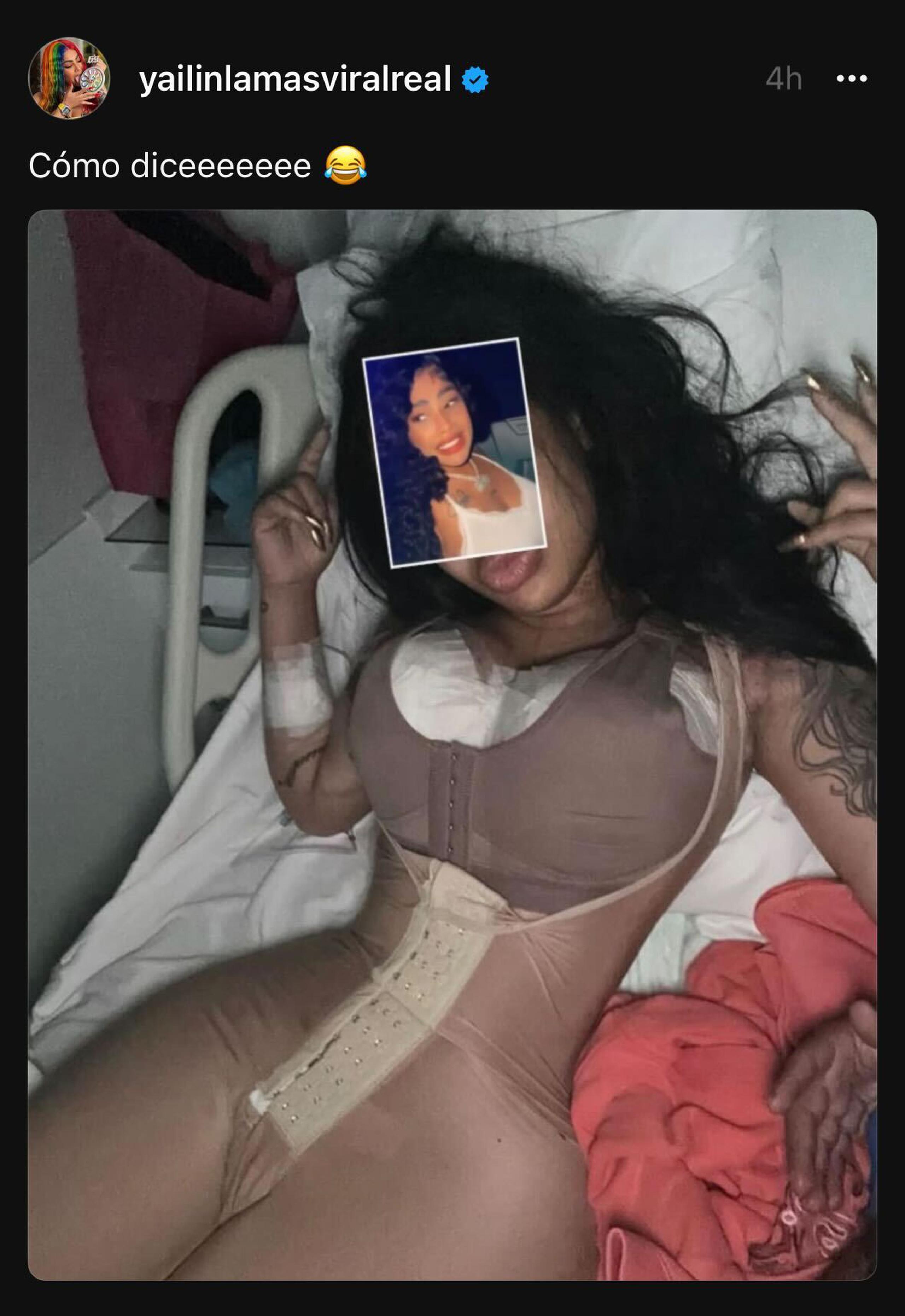 Yailin "La más viral" compartió su cuerpo a días de haber pasado por una cirugía.