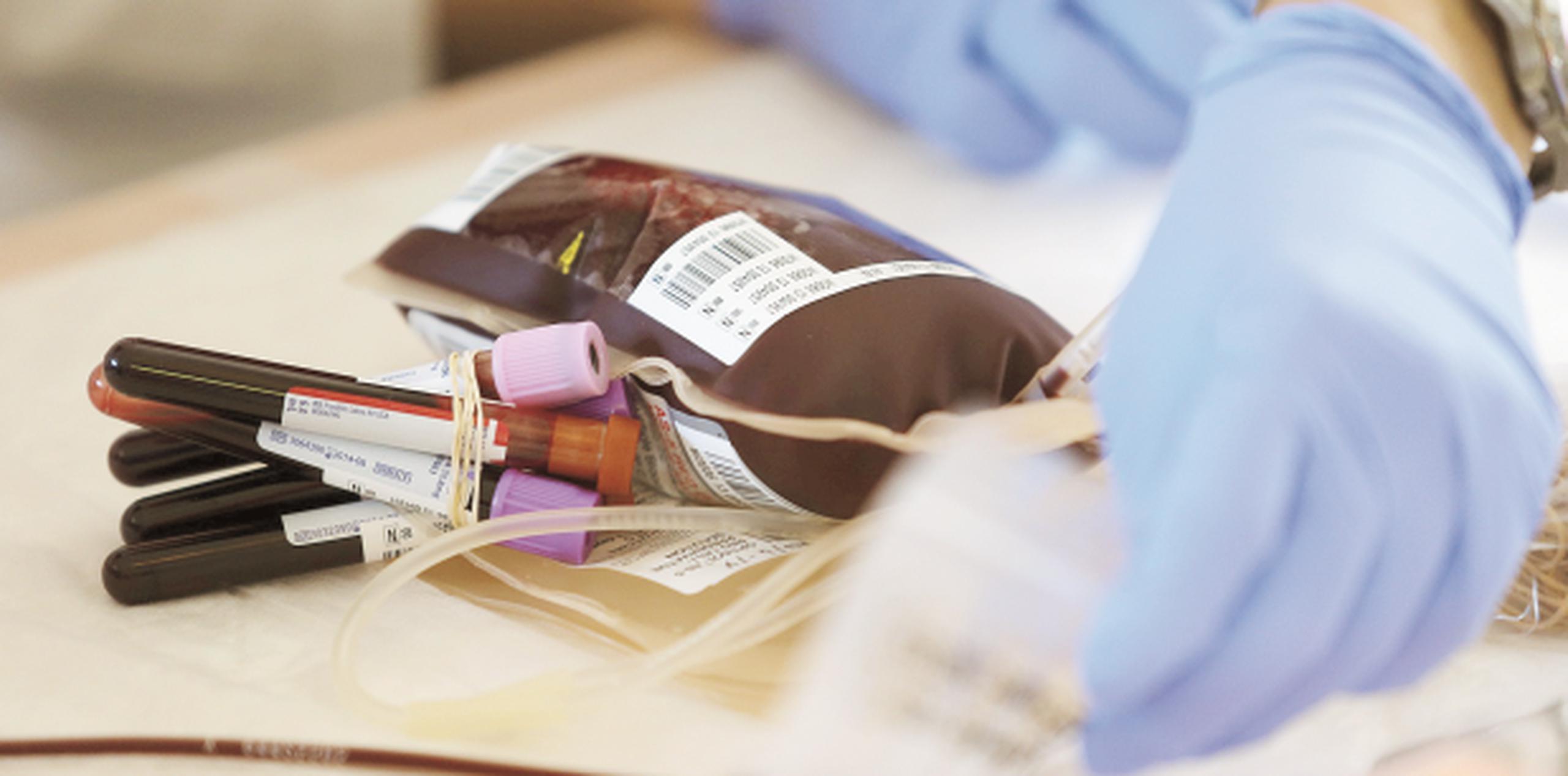 Las donaciones ahora requieren de un quinto tubo de sangre para la prueba del sika, además de la pinta para donación y los cuatro tubos que se colectaban. (Archivo)