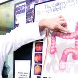 Expertos aconsejan exámenes de cáncer de colon desde 45 años