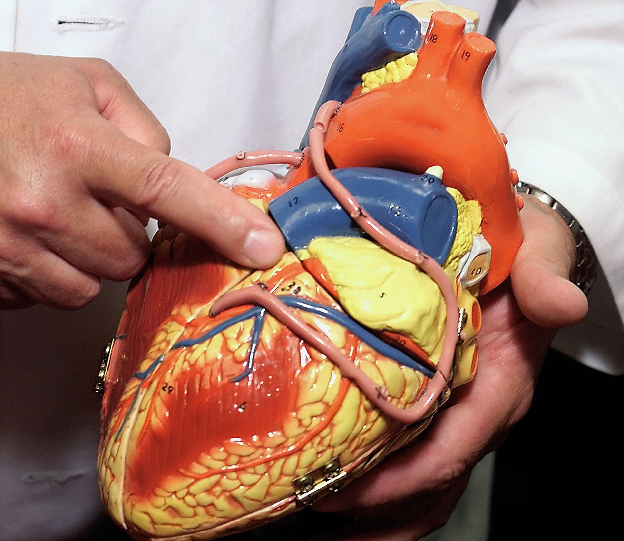 El trasplante del primer corazón totalmente artificial en una persona tuvo lugar en París en diciembre de 2013. (AP)