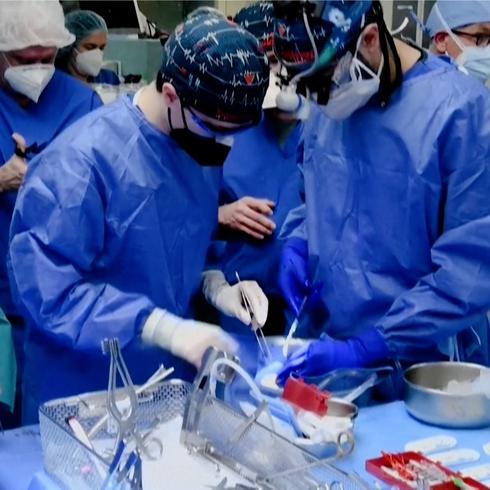 Paciente terminal recibe corazón de cerdo en histórico trasplante