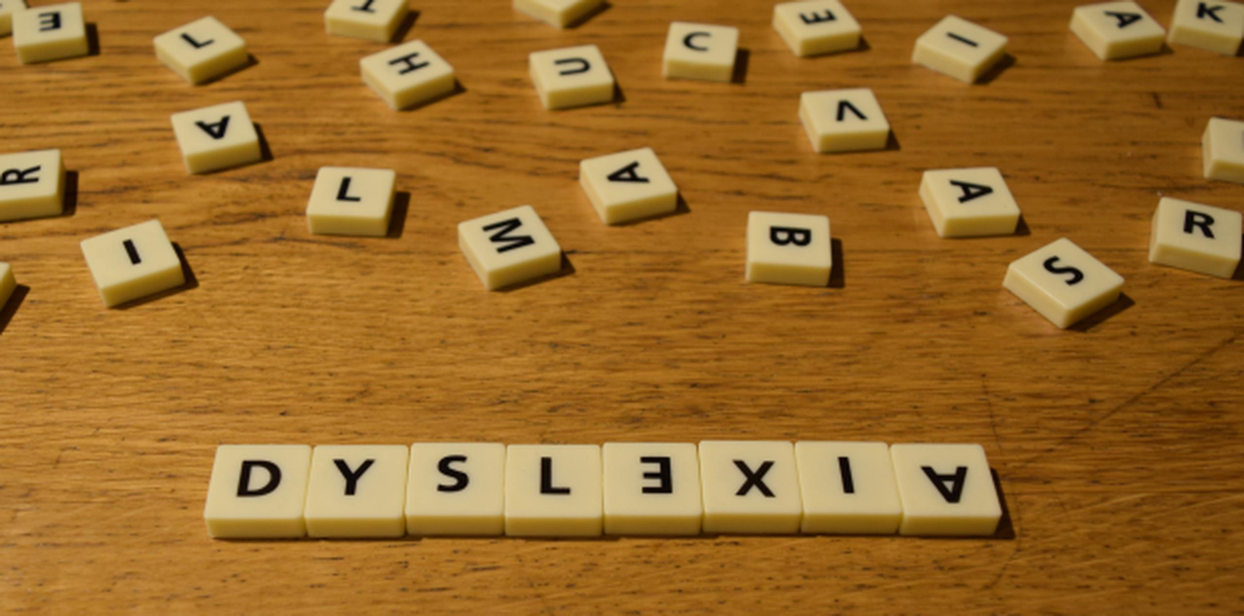 La dislexia es el más conocido de los Trastornos de Aprendizaje y muchas personas lo asocian con la escritura invertida o en espejo. (Shutterstock)