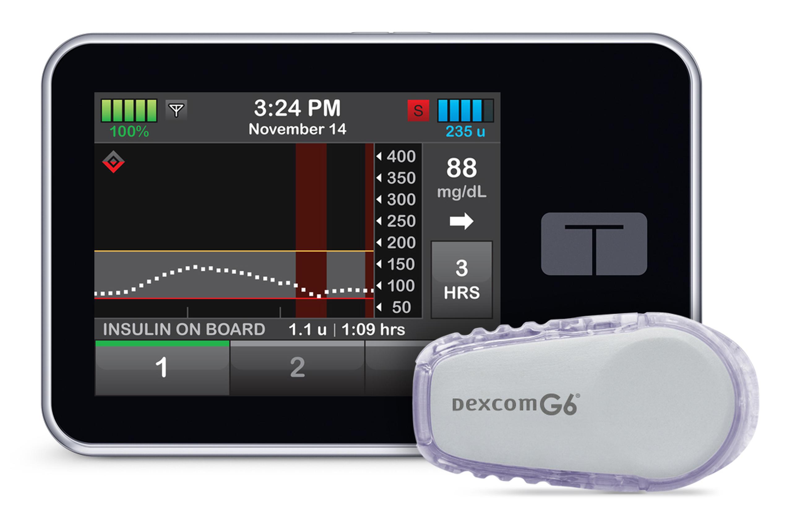 La bomba de insulina Tandem t: slim X2 ™ con tecnología Control-IQ ™ es el primer sistema autorizado por la Administración de Alimentos y Medicamentos capaz de administrar los bolos de insulina de una forma automática.