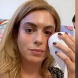 Mónica Pastrana muestra “arreglitos” estéticos que se hizo en la cara