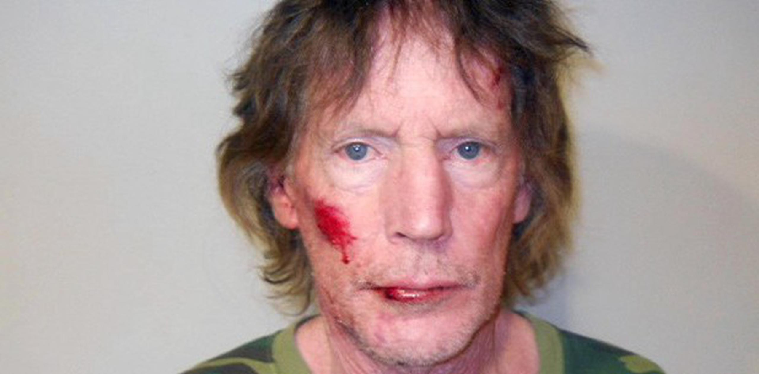 El sospechoso aparece en una foto difundida por el jefe policial del condado Pueblo, con el labio roto y una herida en el pómulo derecho, pero las autoridades afirman que no hubo forcejeo al arrestarlo. (AP)