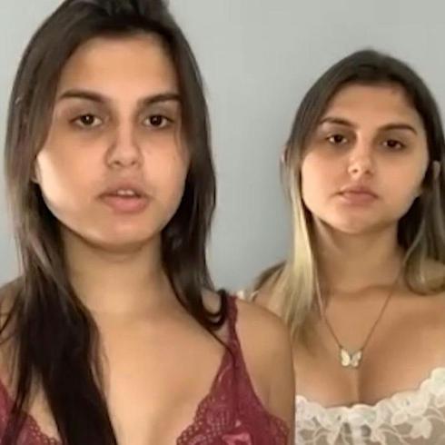 Gemelas trans brasileñas pasan juntas por cirugía de reasignación de sexo