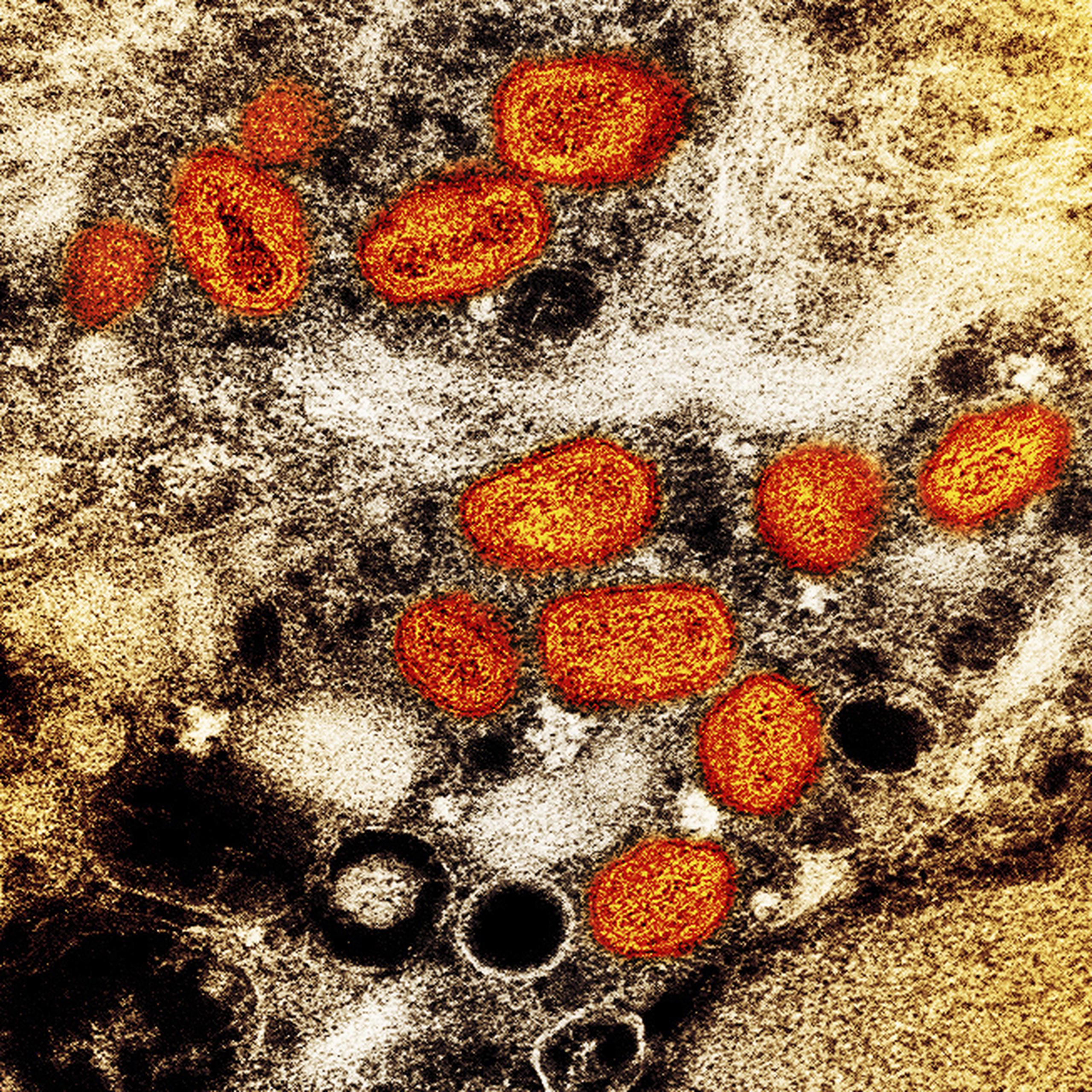 Esta imagen difundida por el Instituto Nacional de Alergias y Enfermedades Infecciosas de Estados Unidos muestra una imagen a color captada con un microscopio electrónico de barrido en el que se ven partículas de viruela símica, en anaranjado, encontradas dentro de una célula infectada cultivada en un laboratorio.