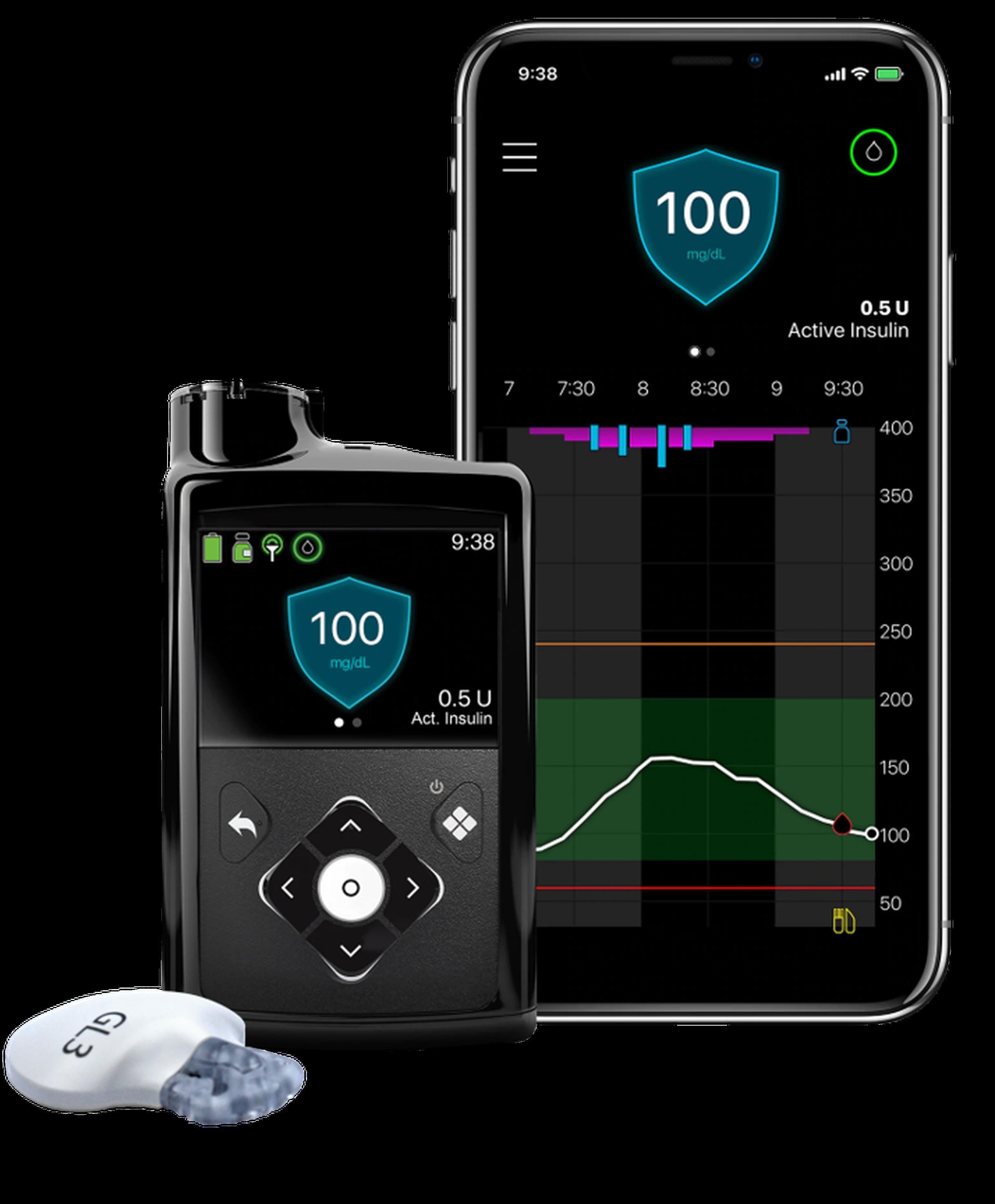 El sistema MiniMed 780G se conecta a un sensor que monitorea, cada cinco minutos, el azúcar del paciente, informando a la bomba los niveles de glucosa en la sangre.