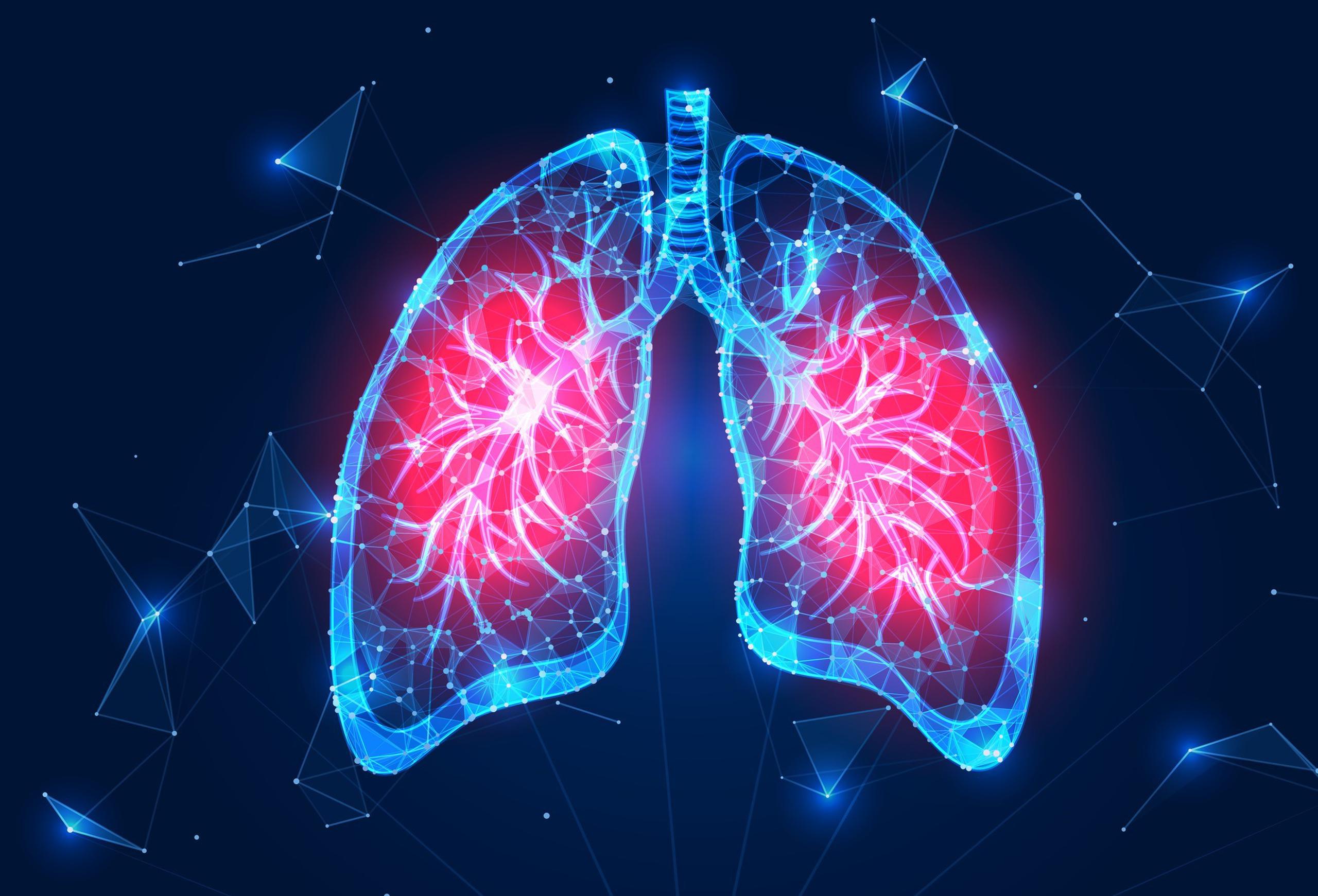Más del 50 % de los casos diagnosticados de cáncer del pulmón fallecerán a causa de esta condición.