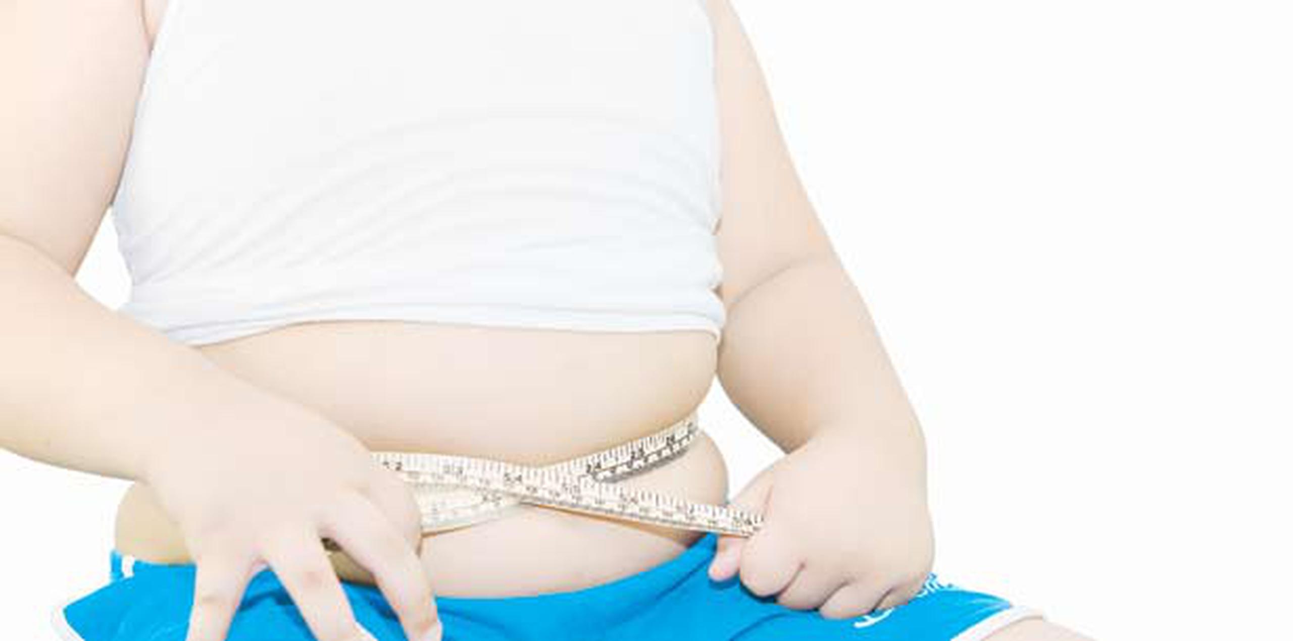 El 65.9% de las personas mayores de 18 años está obeso o en sobrepeso, lo que representa un serio problema de salud que debe ser corregido de inmediato, según expertos. (Archivo)