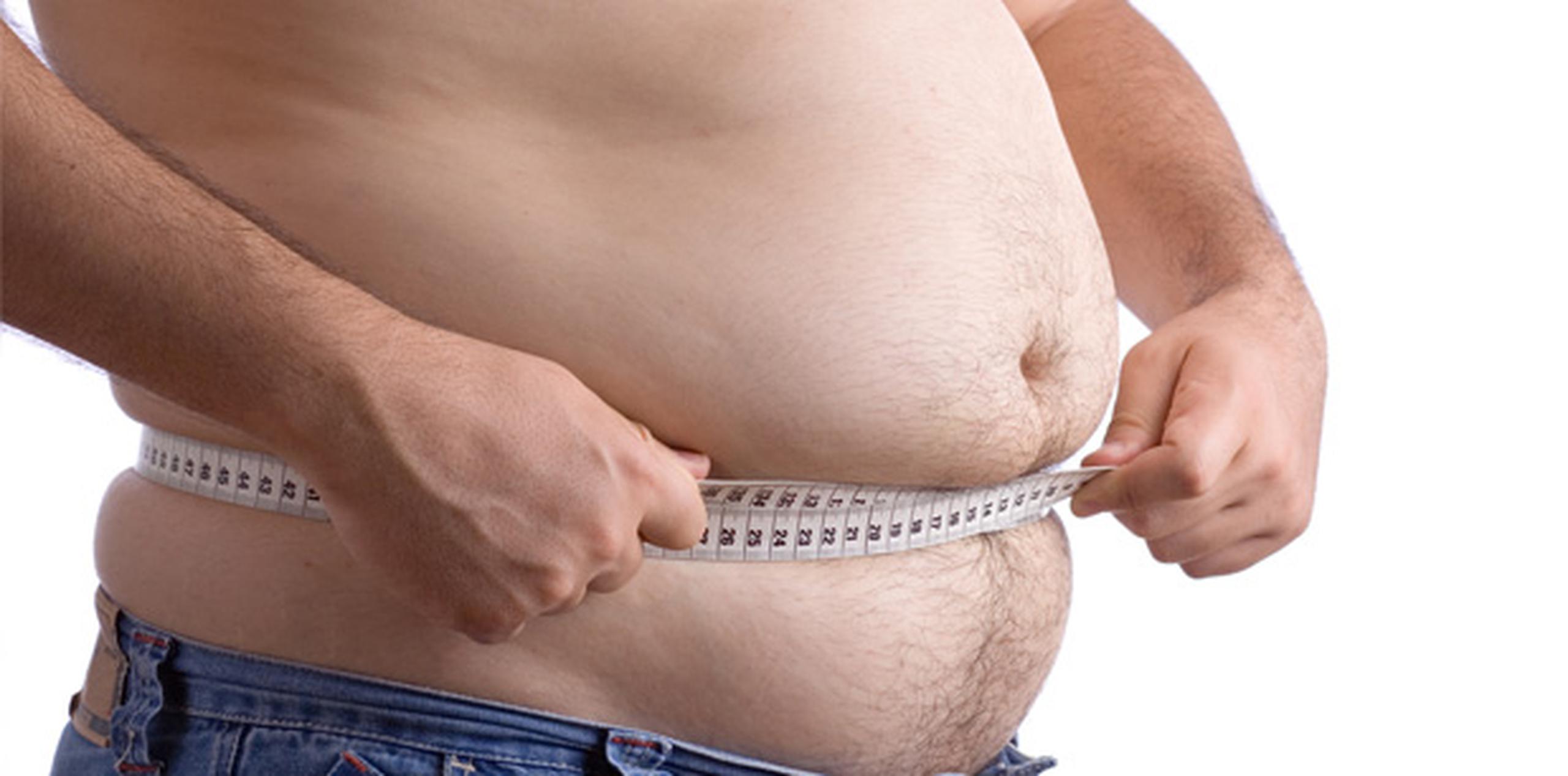 La obesidad —que no significa un simple sobrepeso, sino uno en condición grave— es considerada uno de los principales problemas de salud pública del país.