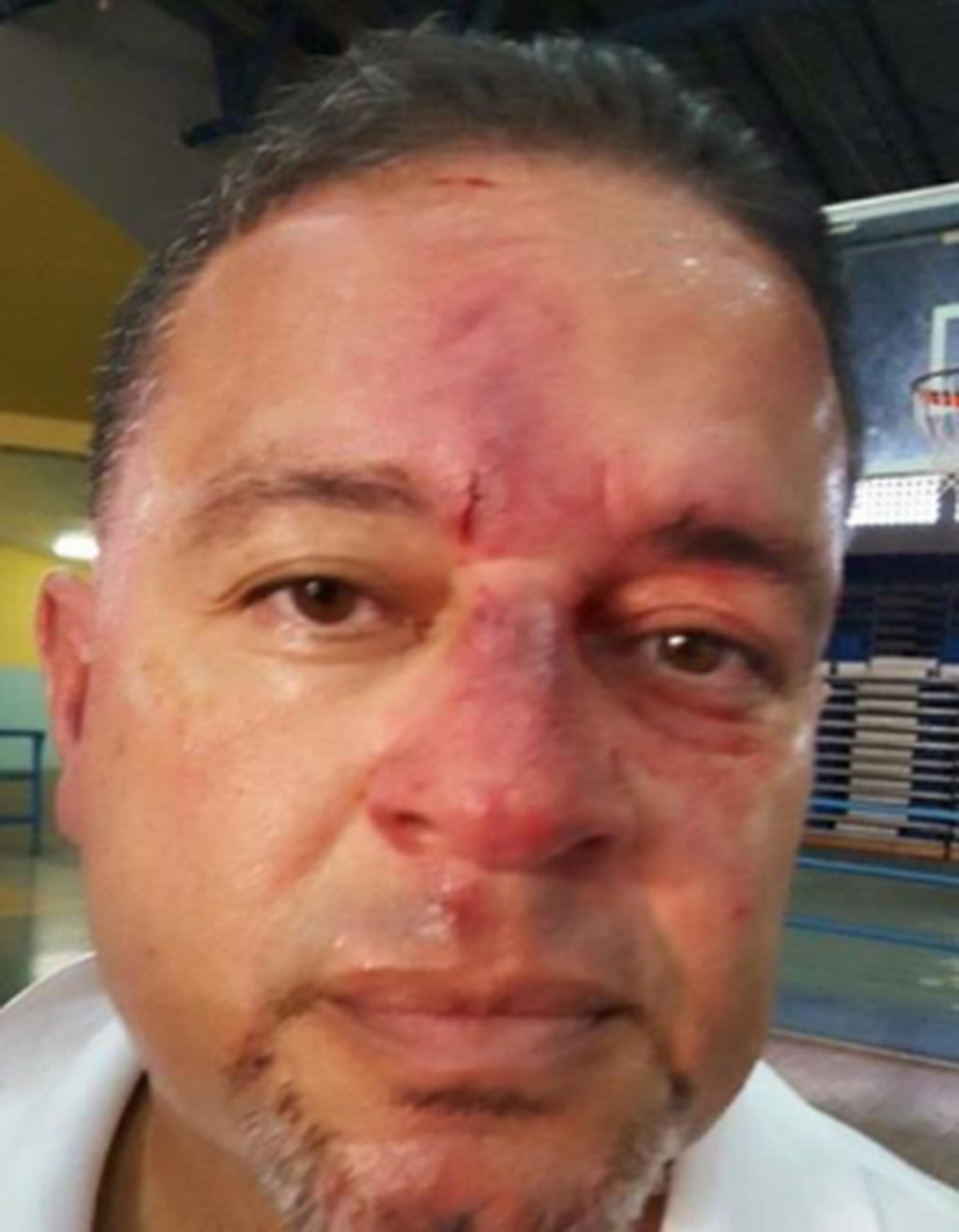 El árbitro fue llevado al hospital Ryder en Humacao por agentes de la policía. (Suministrada)