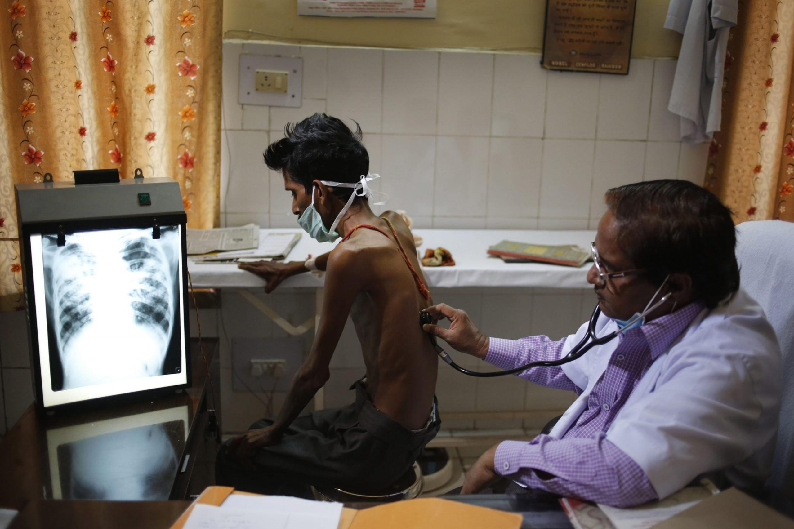 Un médico examina a un paciente con tuberculosis en un hospital gubernamental en Allahabad, India.