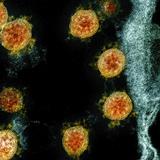 Coronavirus puede ser infeccioso 24 horas al aire libre durante invierno
