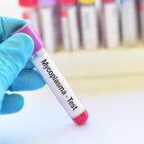 Alertan sobre uso excesivo de antibiótico ante “falsos positivos” de micoplasma