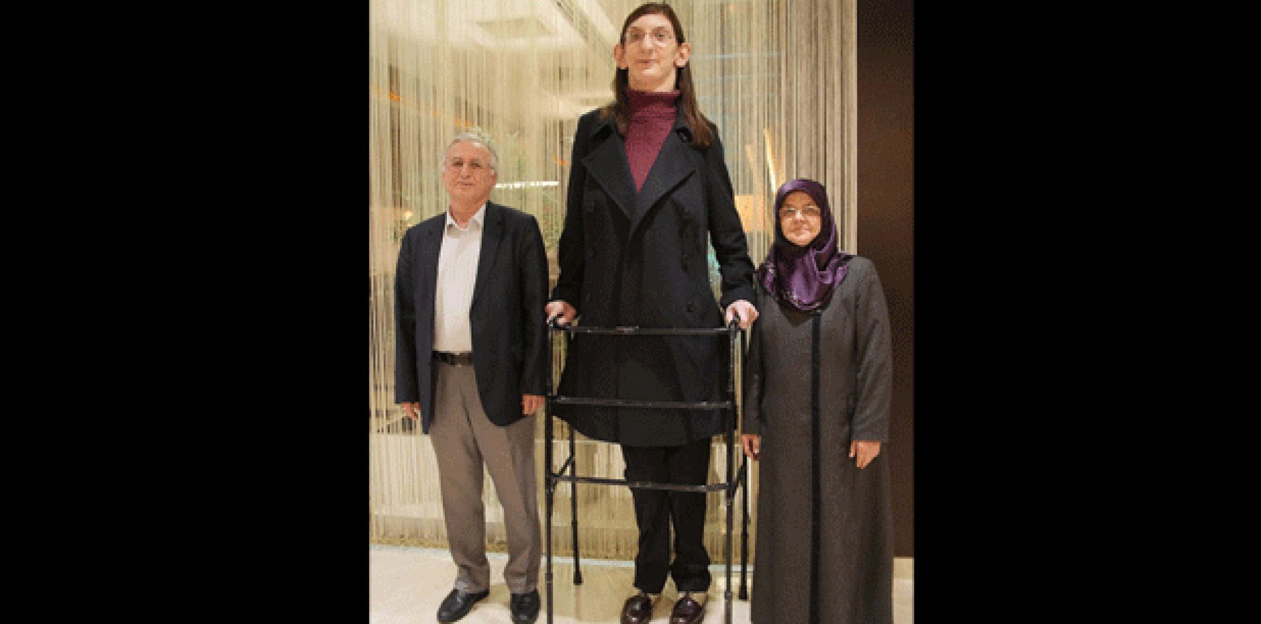 La joven – residente de la ciudad turca de Safranbolu- se debe a que padece del Síndrome de Weaver. (barcroft.tv)