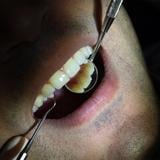 Federales sentencian a dentista colombiano por trabajar sin licencia en Puerto Rico