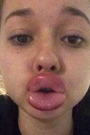 Reacciona Kylie Jenner Al Reto Para Imitar Sus Labios Primera Hora