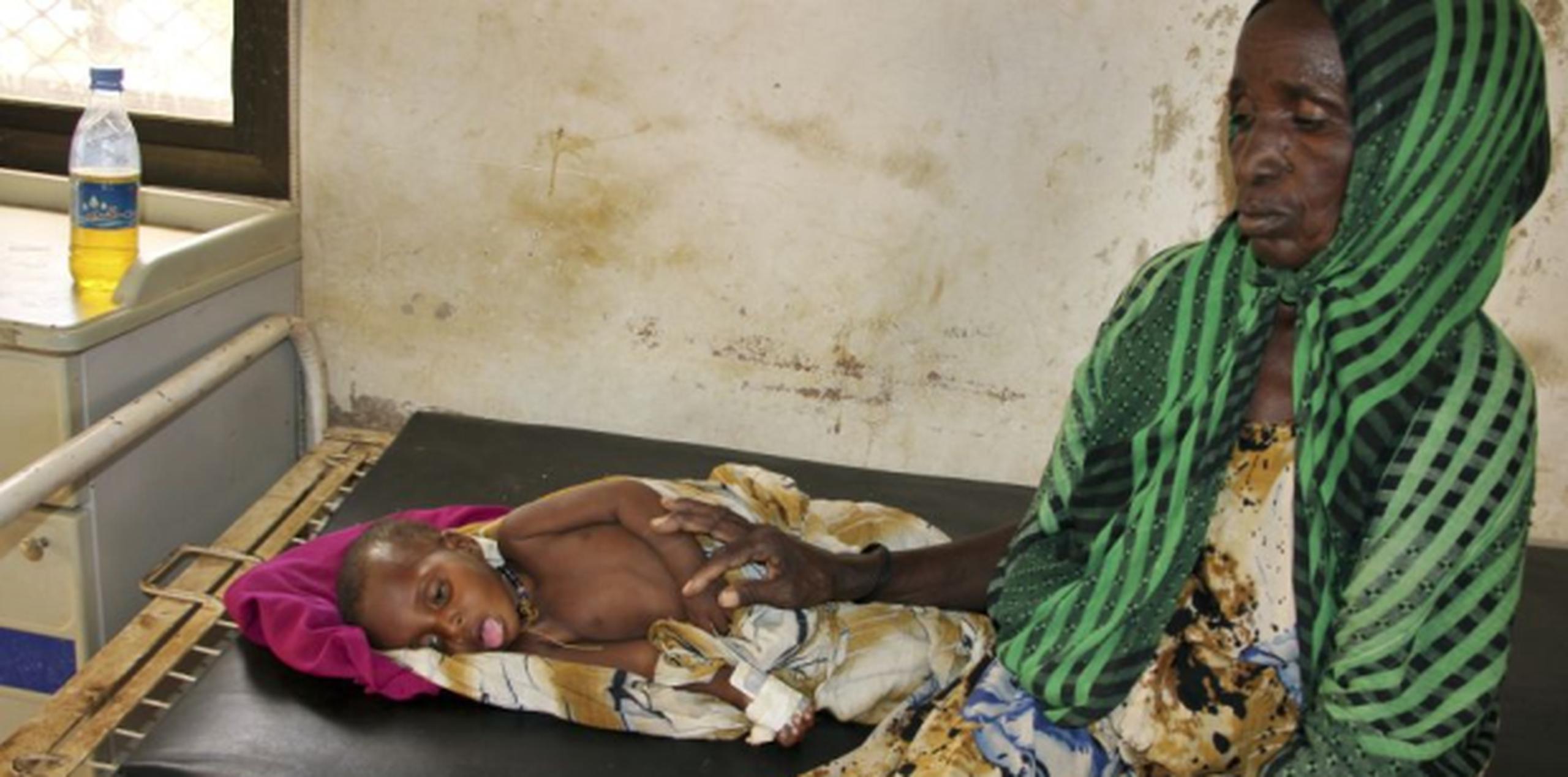 Somalia está abrumada por una epidemia de cólera. (GDA)