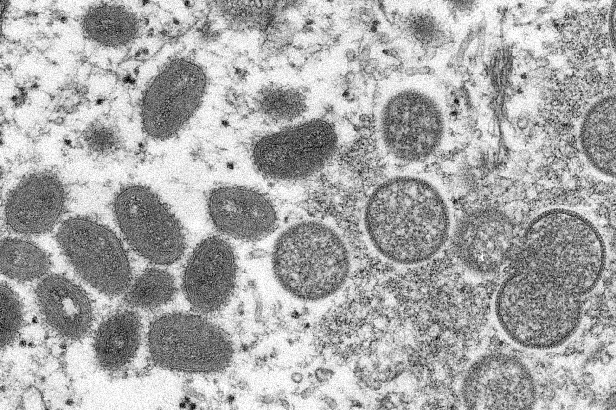 Esta imagen de un microscopio electrónico, proporcionada el 18 de mayo de 2022 por los Centros para el Control y la Prevención de Enfermedades de Estados Unidos, muestra viriones maduros de viruela símica a la izquierda y viriones inmaduros esféricos a la derecha, obtenidos de una muestra de piel humana vinculada con un brote de 2003.